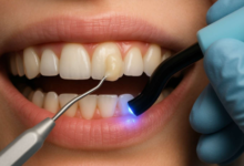 How Restorative Dentistry Complements Whitening And Veneers