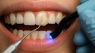 How Restorative Dentistry Complements Whitening And Veneers