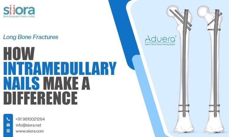 Long Bone Fractures: How Intramedullary Nails Make a Difference