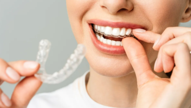 The Role Of Custom Fit In Successful Clear Aligner Treatment