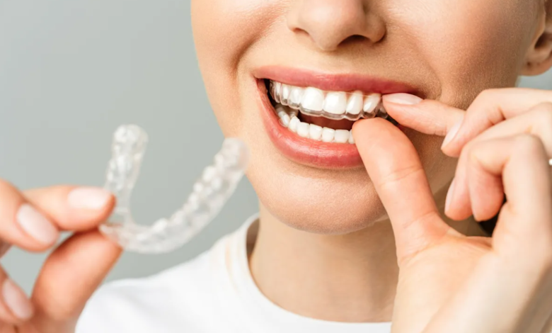 The Role Of Custom Fit In Successful Clear Aligner Treatment