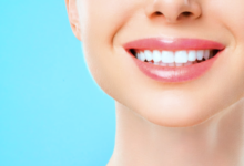 4 Ways Implants Enhance Full Cosmetic Smile Transformations