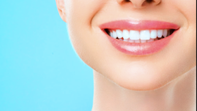 4 Ways Implants Enhance Full Cosmetic Smile Transformations