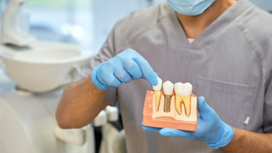 How Cosmetic Dentistry Enhances The Aesthetics Of Implants