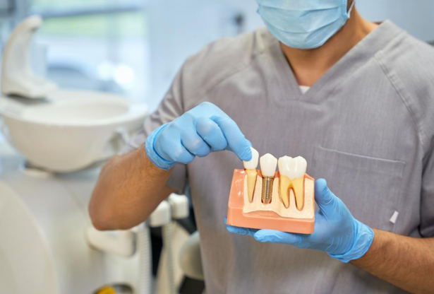 How Cosmetic Dentistry Enhances The Aesthetics Of Implants
